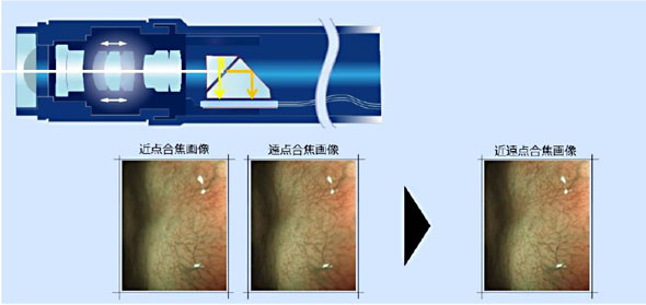 EDOF(被写界深度拡大技術:Extended Depth of Field)