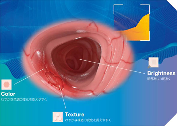 TXI（構造色彩強調機能：Texture and Color Enhancement Imaging）