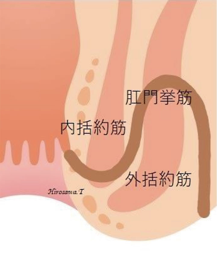 骨盤直腸窩痔瘻（深部痔瘻）