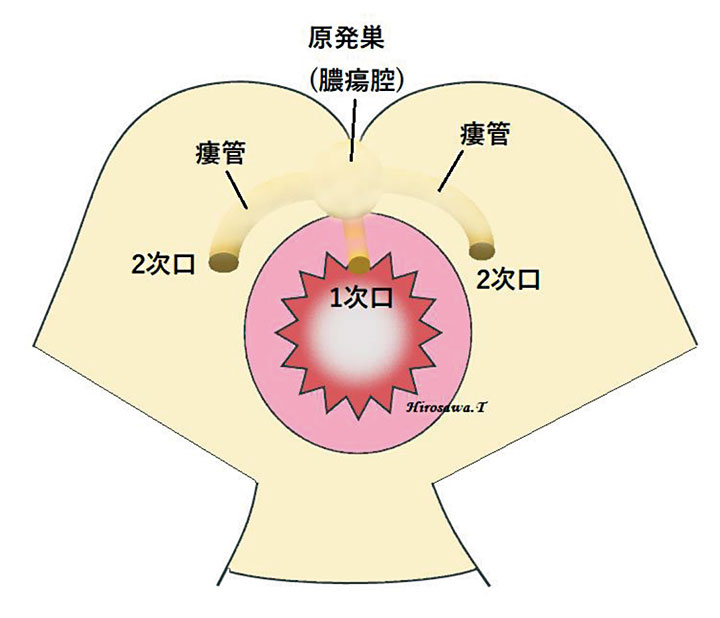 (外肛門括約筋)外側アプローチ法1