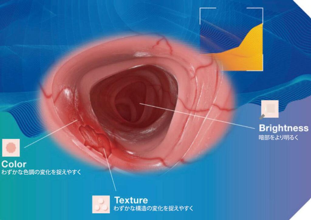 TXI（構造色彩強調機能：Texture and Color Enhancement Imaging）