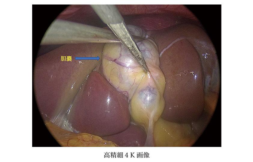 高精細4K画像