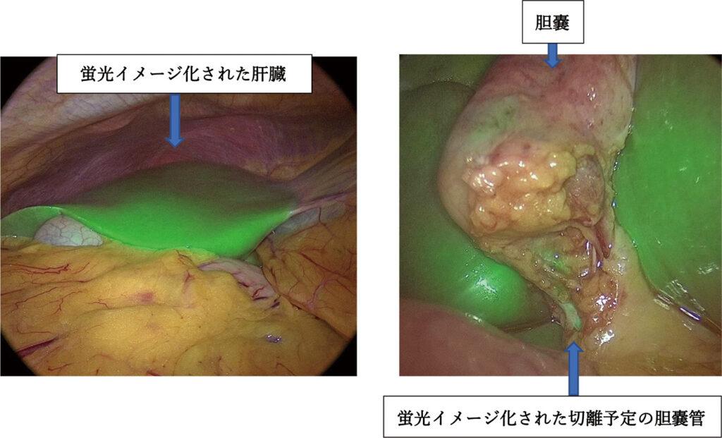 蛍光イメージ化