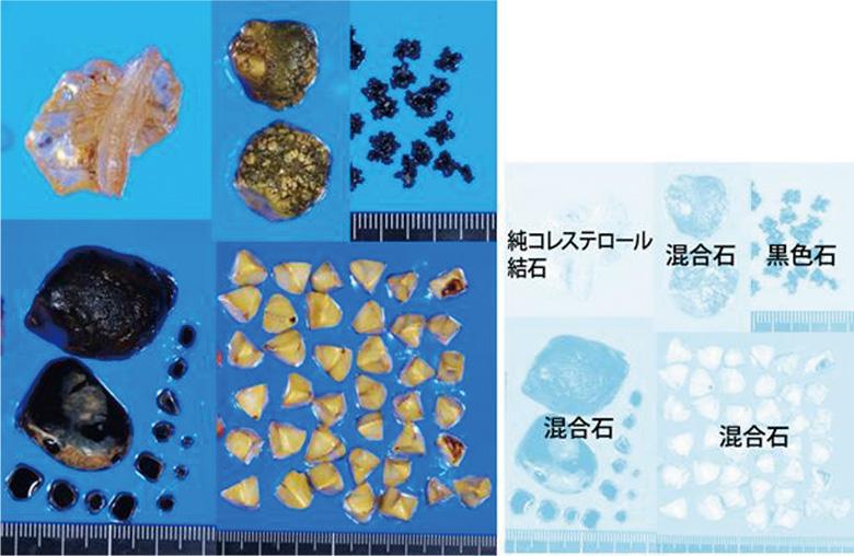 日本臨床外科学会HPより引用