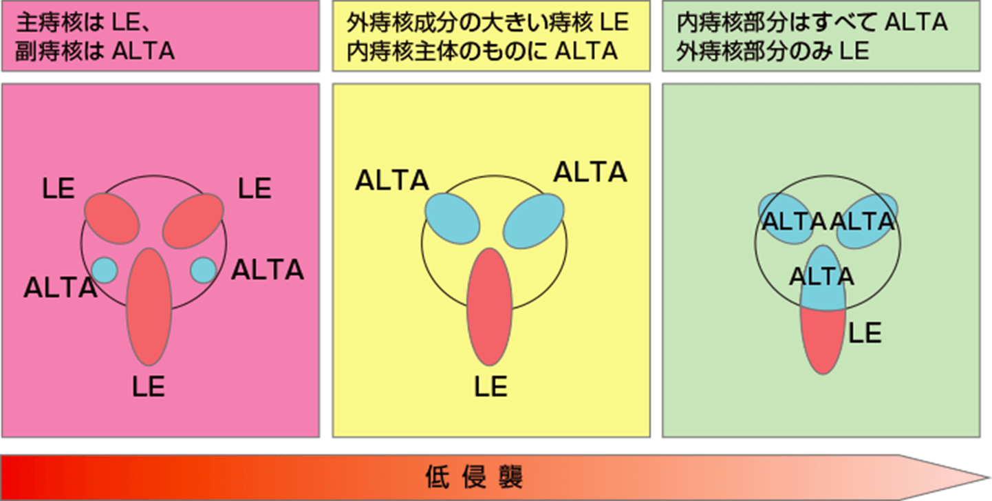 痔核(いぼ痔) | 宮城県大崎市 北みやぎ外科クリニック