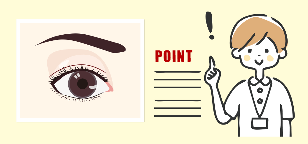 眼瞼下垂症の手術適応（保険適応）について
