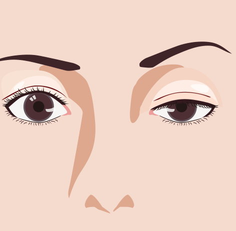 眼瞼下垂イラスト